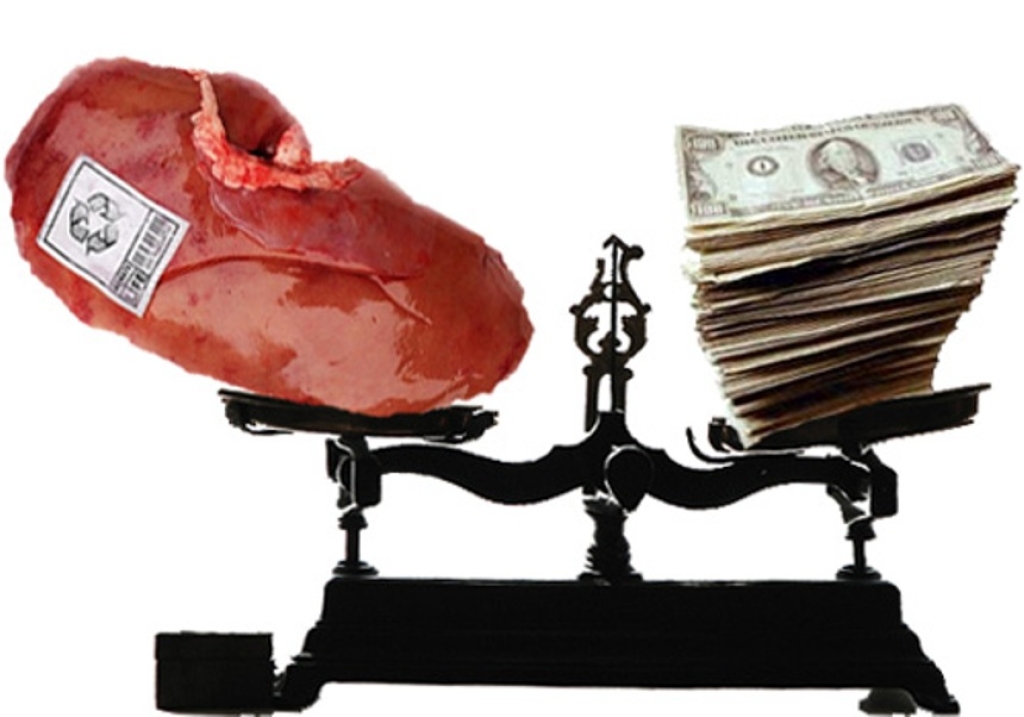 Продажа органов: продать свои органы за деньги + законные способы, сколько можно получить, куда обращаться