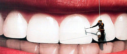 Вред здоровья в стоматологии: Что делать если причинен вред. Как взыскать компенсацию, или что бы переделали все