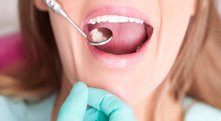 Срок годности на пломбы - что делать если не хотят восстанавливать у стоматолога