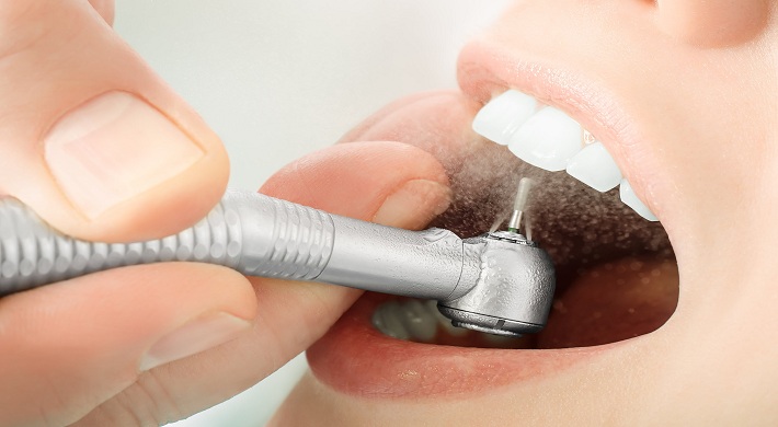 Срок годности на пломбы - что делать если не хотят восстанавливать у стоматолога